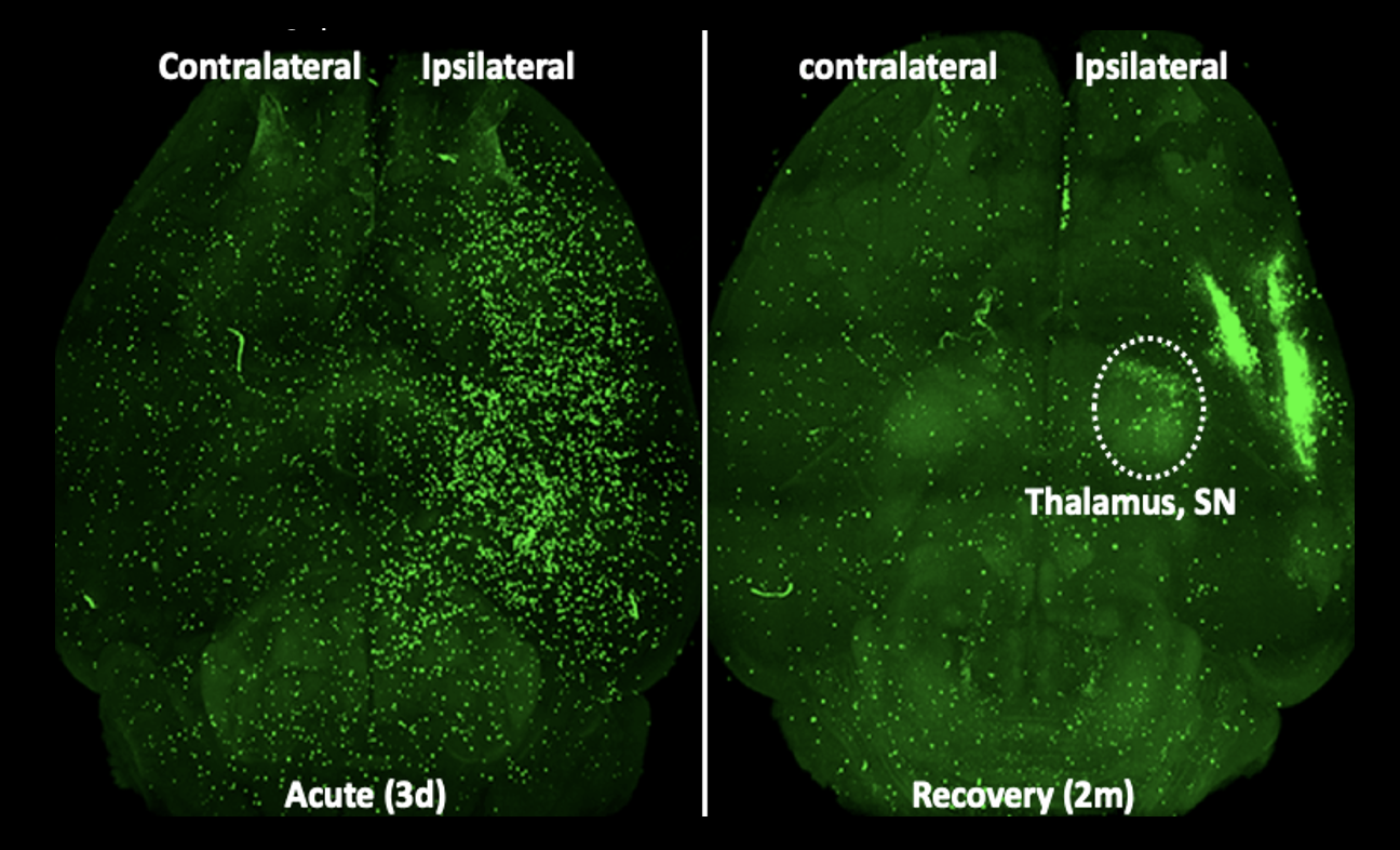 Figure 1: Representative horizontal view images from cleared whole brain at 3d and 2m post-stroke.