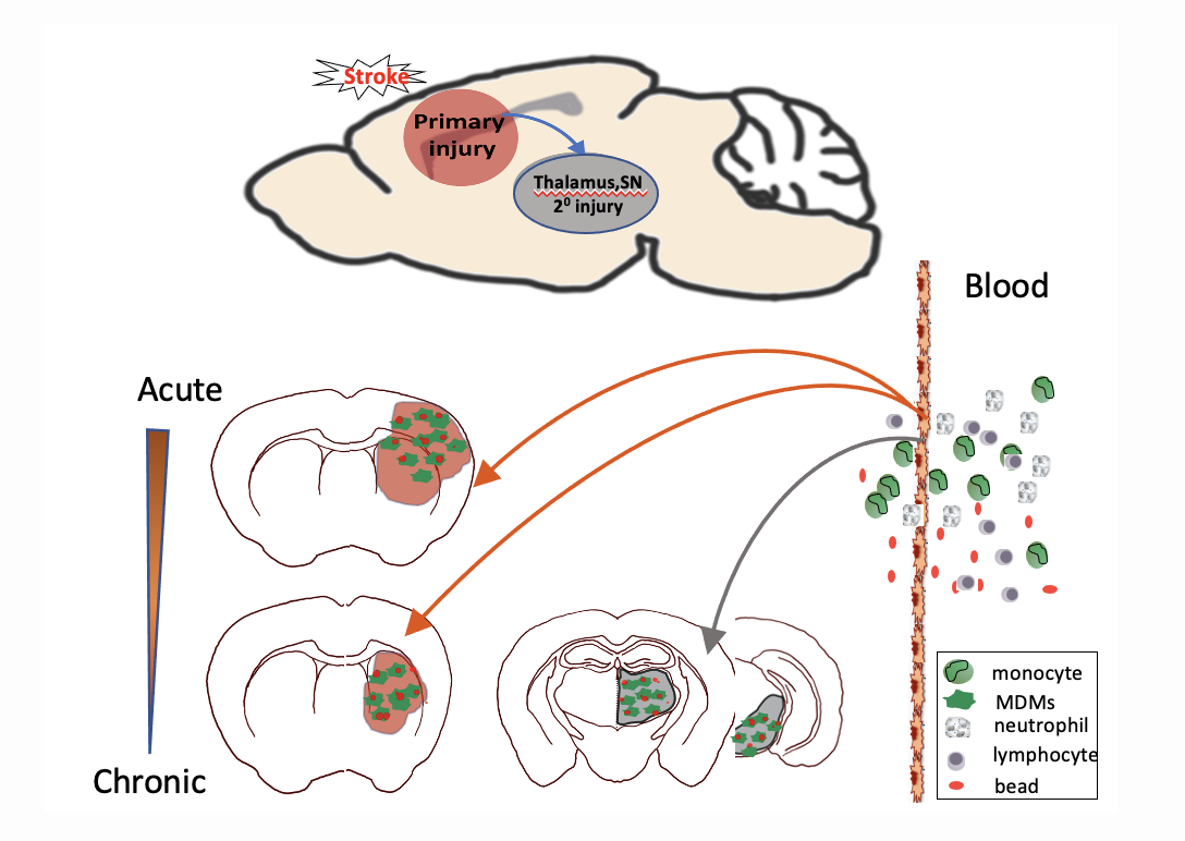 Figure 2: Illustration of Spatiotemporally regulated monocyte trafficking and brain atrophy in chronic stroke.