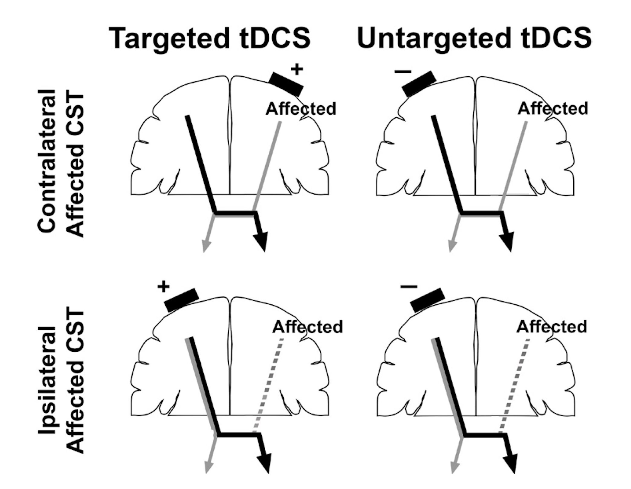 CST connectivity patterns and tDCS montages.