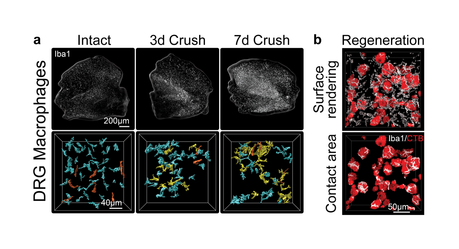 Figure 3: Sciatic nerve crush triggers macrophage interactions with regenerating sensory neurons in the dorsal root ganglia (DRG). 