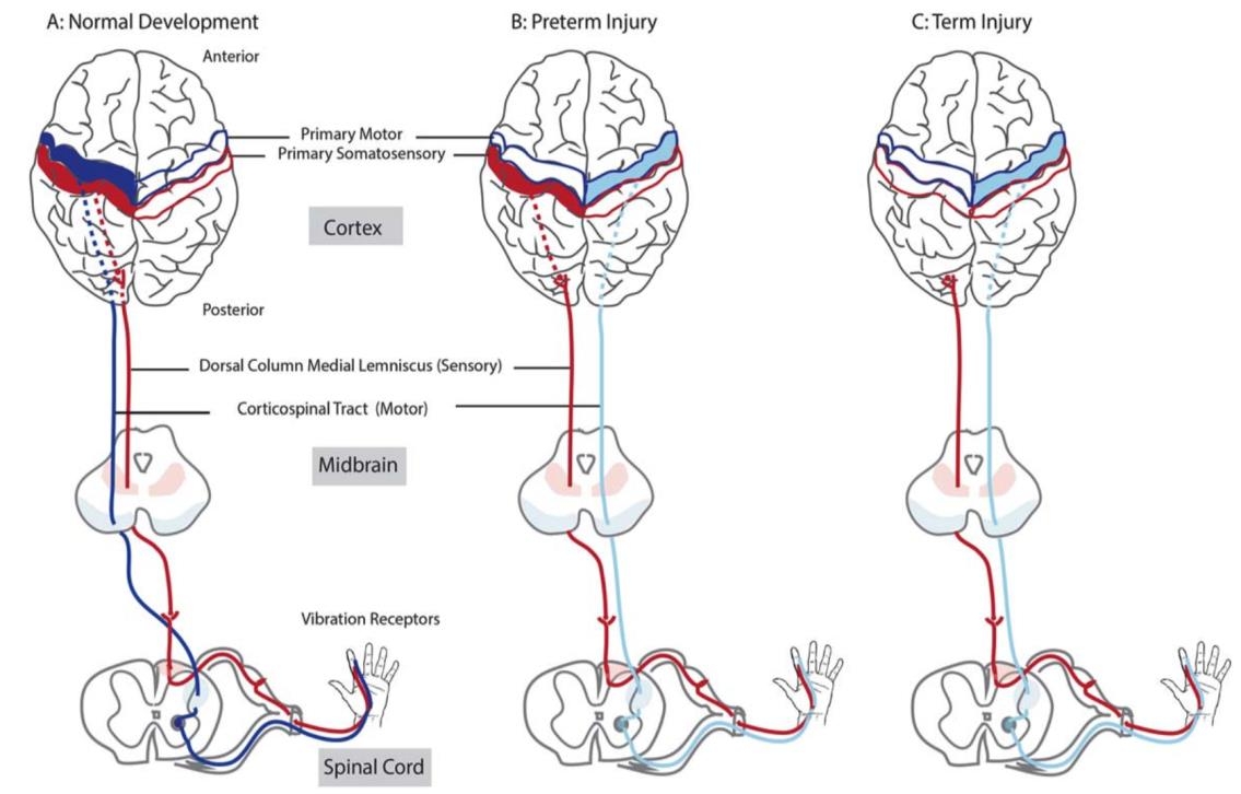 Jason B. Carmel, M.D., Ph.D. Figure