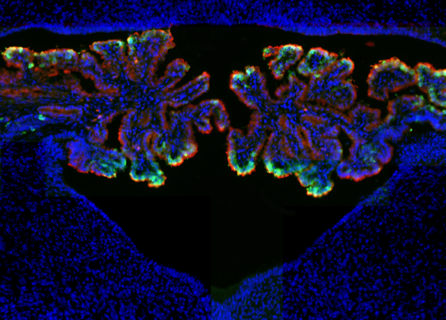 Dr. Maria Lehtinen's Figure