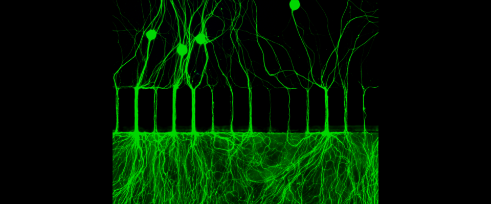 Epifluorescent image of DRG neurons grown in microfluidic devices. Epifluorescent image of DRG neurons grown in microfluidic devices.