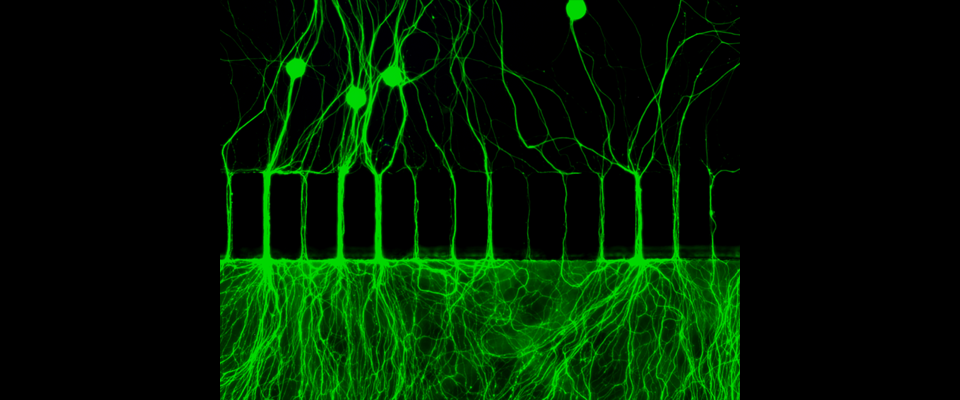 Epifluorescent image of DRG neurons grown in microfluidic devices.