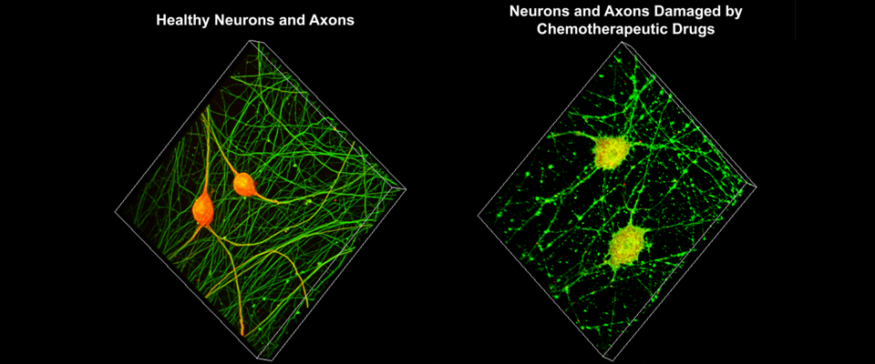 3-D rendering of confocal z-stacks of dorsal root ganglion neurons.